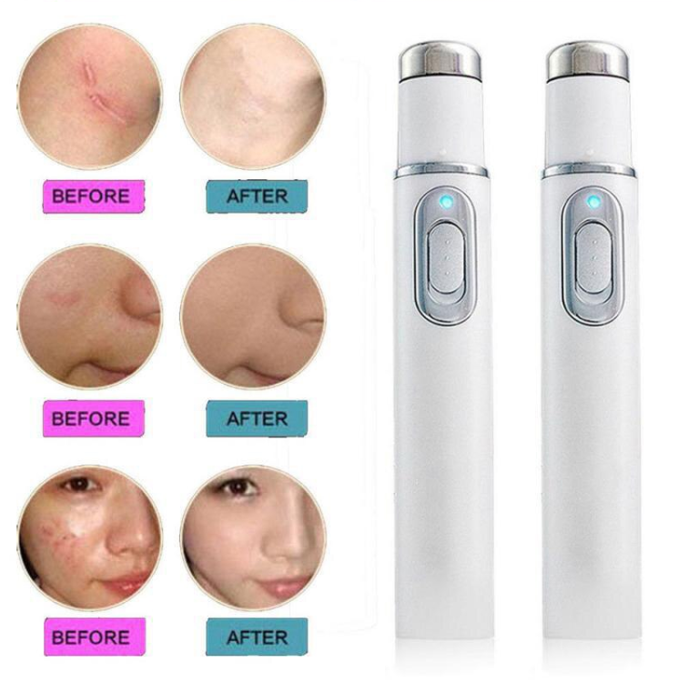 Acne Laser Pen