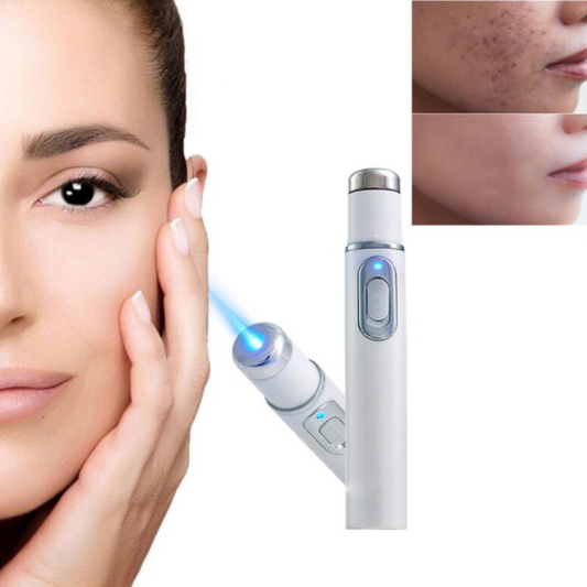 Acne Laser Treatment Pen 